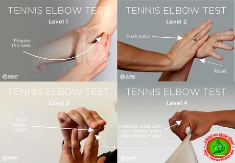 Tennis Elbow Causes, Symptoms, Treatment