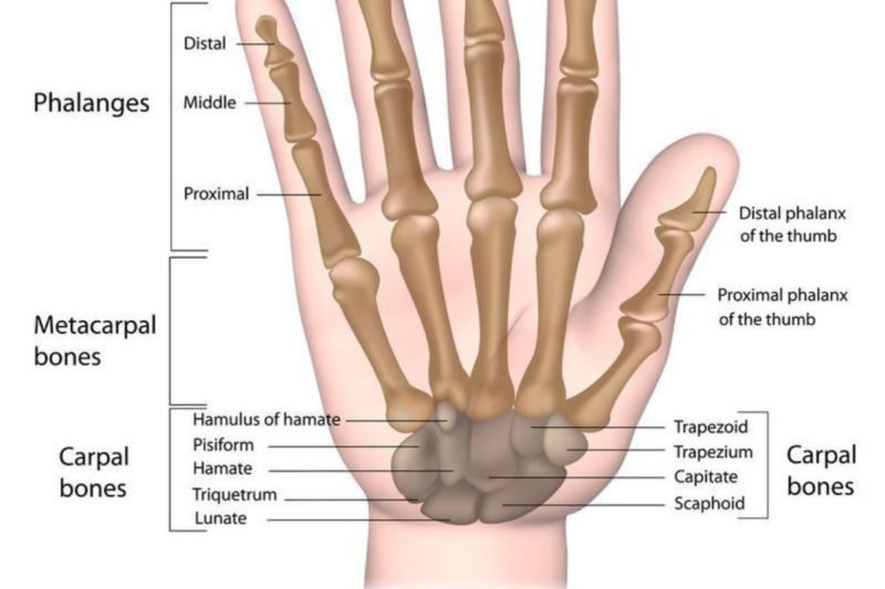 Avascular Necrosis of the Lunate - Symptoms, Treatment Avascular Necrosis of the Lunate - Symptoms, Treatment