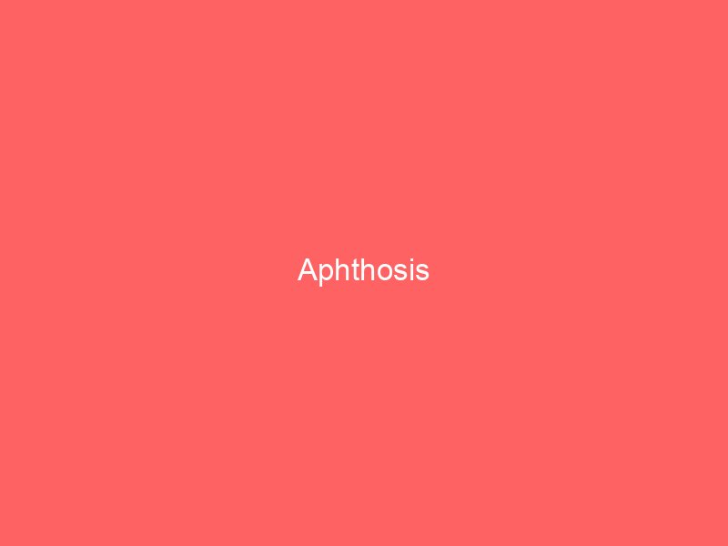 Recurrent Aphthous Stomatitis