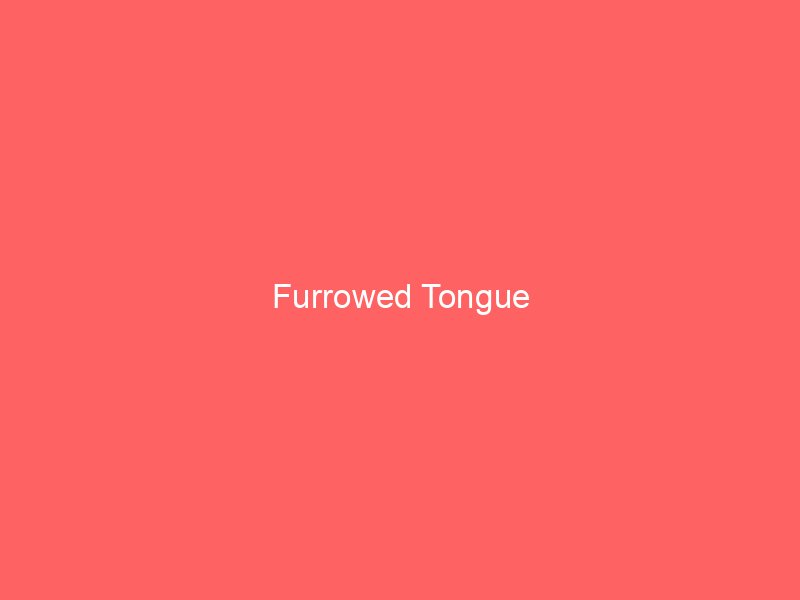 Fissured Tongue