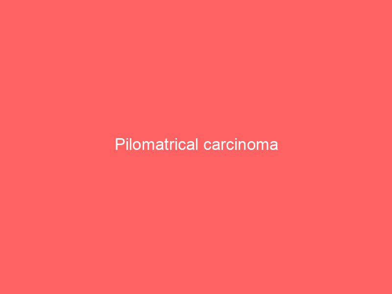 Malignant Pilomatricoma