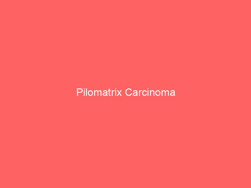 Pilomatrical carcinoma